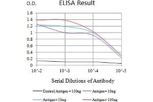 Black line: Control Antigen (100 ng),Purple line: Antigen (10 ng), Blue line: Antigen (50 ng), Red line:Antigen (100 ng) (IL21 Receptor antibody  (AA 20-232))