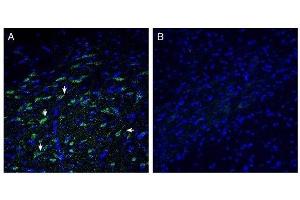 Expression of ZnT10 in rat basal ganglia. (SLC30A10 antibody  (C-Term, Intracellular))