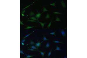 Immunofluorescence analysis of NIH-3T3 cells using p38 MAPK antibody (ABIN7268616) at dilution of 1:100.