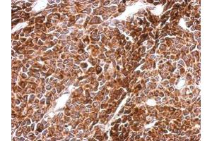 IHC-P Image Immunohistochemical analysis of paraffin-embedded BT483 xenograft, using PHF16, antibody at 1:500 dilution. (PHF16 antibody  (C-Term))