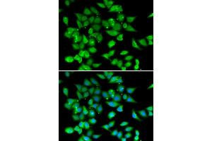 Immunofluorescence analysis of HeLa cells using NFATC3 antibody (ABIN5974017).