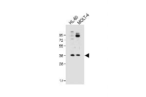 All lanes : Anti-RQCD1 Antibody (Center) at 1:500 dilution Lane 1: HL-60 whole cell lysate Lane 2: MOLT-4 whole cell lysate Lysates/proteins at 20 μg per lane. (RQCD1 antibody  (AA 106-134))