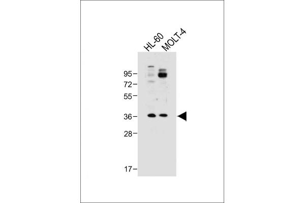 RQCD1 anticorps  (AA 106-134)