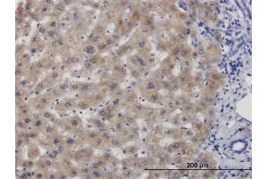 Immunoperoxidase of monoclonal antibody to CBS on formalin-fixed paraffin-embedded human liver. (CBS antibody  (AA 1-100))