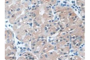 Immunohistochemistry (IHC) image for anti-phospholipase C, beta 1 (phosphoinositide-Specific) (PLCB1) (AA 316-476) antibody (ABIN7444274)