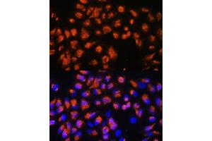 Immunofluorescence analysis of HeLa cells using AGRN Rabbit pAb (ABIN7265516) at dilution of 1:100. (AGRN antibody  (AA 30-350))