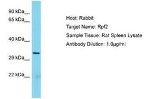 Image no. 1 for anti-Ribosome Production Factor 2 Homolog (RPF2) (AA 77-126) antibody (ABIN6750445)