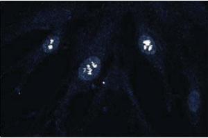 Immunofluorescence staining of human fibroblasts. (CDK4 antibody  (AA 1-303))