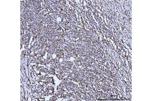 IHC analysis of GLUD1/2 using anti-GLUD1/2 antibody (ABIN7602000). (GLUD1 / GLUD2 (AA 54-553) antibody)