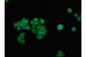 Immunofluorescence staining of PC-3 cells with ABIN7156602 at 1:100, counter-stained with DAPI. (IFNGR2 antibody  (AA 28-205))