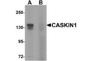 Western blot analysis of CASKIN1 in HeLa cell lysate with CASKIN1 Antibody  at 1 μg/ml in (A) the absence and (B) the presence of blocking peptide. (CASKIN1 antibody  (Middle Region))