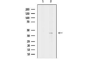 anti-Motor Neuron and Pancreas Homeobox 1 (MNX1) (C-Term) antibody