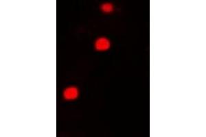 Immunofluorescent analysis of FIP1L1 staining in A549 cells. (FIP1L1 antibody)