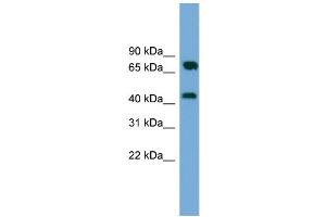 WB Suggested Anti-MAT2A Antibody Titration: 0. (MAT2A antibody  (Middle Region))