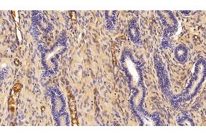 Detection of Hpt in Porcine Uterus Tissue using Polyclonal Antibody to Haptoglobin (Hpt) (Haptoglobin antibody  (AA 123-307))