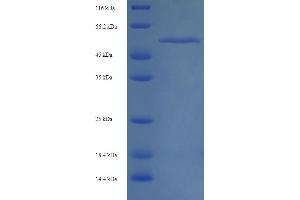 CAPSD (AA 1-530), (full length) protein (His tag)