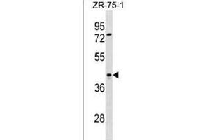 SIRPB2 Antibody (C-term) (ABIN1536893 and ABIN2838213) western blot analysis in ZR-75-1 cell line lysates (35 μg/lane). (SIRPb2 antibody  (C-Term))