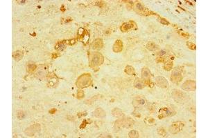 Immunohistochemistry of paraffin-embedded human placenta tissue using ABIN7165176 at dilution of 1:100 (CNPY4 antibody  (AA 22-248))