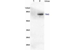 L1 rat brain, L2 human colon carcinoma lysates probed (ABIN746558) at 1:200 in 4 °C. (CRTC1 antibody  (pSer151))