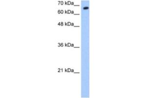 Western Blotting (WB) image for anti-Synovial Apoptosis Inhibitor 1, Synoviolin (SYVN1) antibody (ABIN2462687) (SYVN1 antibody)