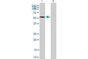 Western Blot analysis of STK17A expression in transfected 293T cell line by STK17A monoclonal antibody (M03), clone 4D12.