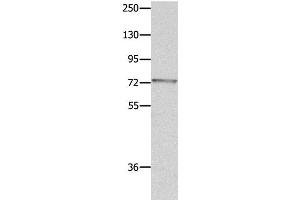 Western Blot analysis of Mouse eye tissue using MUC20 Polyclonal Antibody at dilution of 1:1400 (MUC20 antibody)