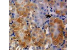 Used in DAB staining on fromalin fixed paraffin-embedded Kidney tissue (Midkine antibody  (AA 22-143))