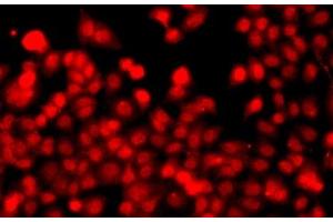 Immunofluorescence analysis of A549 cells using THAP1 Polyclonal Antibody (THAP1 antibody)