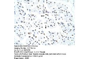 Rabbit Anti-HNRPUL1 Antibody  Paraffin Embedded Tissue: Human Muscle Cellular Data: Skeletal muscle cells Antibody Concentration: 4. (HNRNPUL1 antibody  (C-Term))