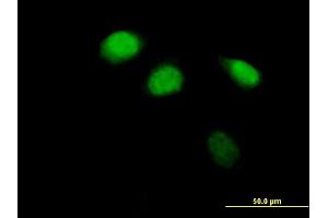 Immunofluorescence of purified MaxPab antibody to ZBTB12 on HeLa cell.