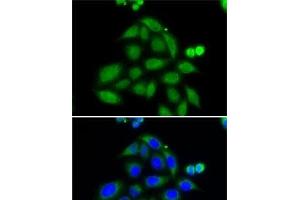Immunofluorescence analysis of MCF7 cells using ELAC2 Polyclonal Antibody (ELAC2 antibody)