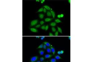 Immunofluorescence analysis of MCF7 cells using ELAC2 Polyclonal Antibody (ELAC2 antibody)