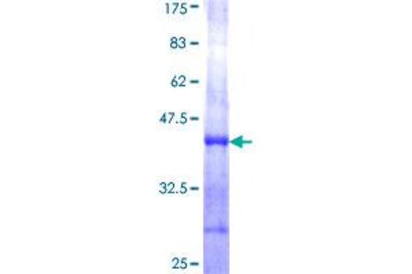 Chymotrypsin Protein (CTRL) (AA 83-191) (GST tag)
