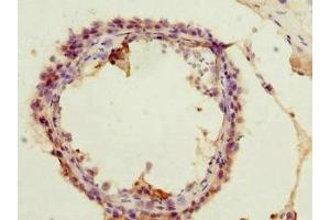 Immunohistochemistry of paraffin-embedded human testis tissue using ABIN7142950 at dilution of 1:100 (ACSS2 antibody  (AA 462-701))