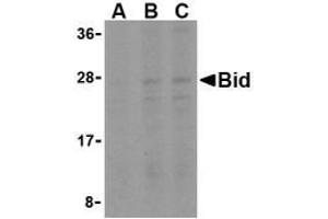 Western blot analysis of Bid in A549 cell lysates with Bid AP30148PU-N antibody at (A) 0.