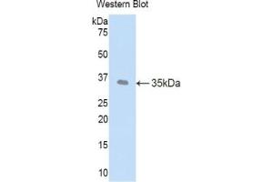 Detection of Recombinant LEFTY1, Human using Polyclonal Antibody to Left/Right Determination Factor 1 (LEFTY1) (LEFTY1 antibody  (AA 78-361))