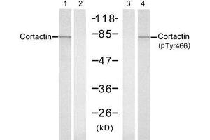 Western blot analysis of extracts from Hela cells, untreated or treated with UV (20min), using Cortactin (Ab-466) antibody (E021264, Lane 1 and 2) and Cortactin (Phospho-Tyr466) antibody (E011272, Lane 3 and 4). (Cortactin antibody)