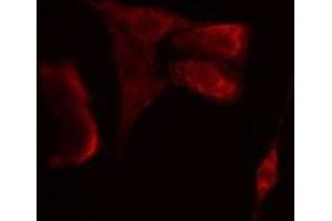 ABIN6275709 staining  A549 cells by IF/ICC. (RAD23B antibody  (N-Term))