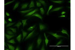 Immunofluorescence of monoclonal antibody to CCBL1 on HeLa cell. (CCBL1 antibody  (AA 1-374))