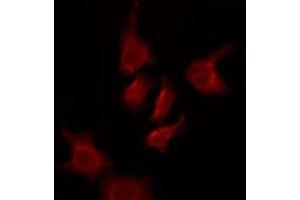 ABIN6276096 staining HuvEc by IF/ICC. (OR5AK3P antibody)