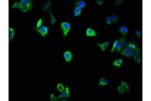 Immunofluorescence staining of HepG2 cells with ABIN7169521 at 1:266, counter-stained with DAPI. (SCOC antibody  (AA 1-121))