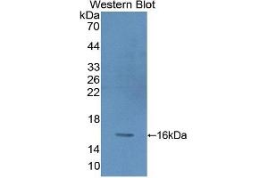 Detection of Recombinant PKIg, Human using Polyclonal Antibody to Protein Kinase Inhibitor Gamma (PKIg) (PKIG antibody  (AA 1-76))