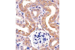 Paraformaldehyde-fixed, paraffin embedded mouse kidney tissue, Antigen retrieval by boiling in sodium citrate buffer (pH6. (RPS6 antibody)