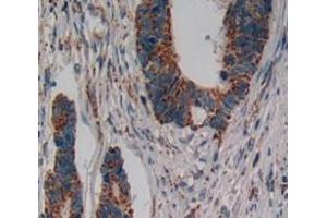 IHC-P analysis of Human Tissue, with DAB staining. (IL17RD antibody  (AA 157-299))
