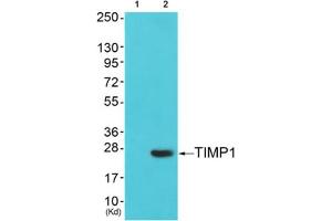 Western blot analysis of extracts from cos-7 cells (Lane 2), using TIMP1 Antibody. (TIMP1 antibody  (Internal Region))