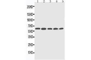 Anti-CYP2U1 antibody, Western blotting Lane 1: HELA Cell Lysate Lane 2: MCF-7 Cell Lysate Lane 3: MM453 Cell Lysate Lane 4: COLO320 Cell Lysate Lane 5:  Cell Lysate