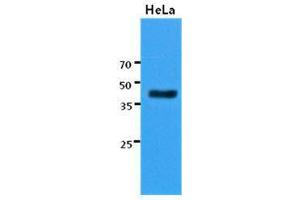 The cell lysates of HeLa (30 ug) were resolved by SDS-PAGE, transferred to PVDF membrane and probed with KRT23 antibody (1:3000). (KRT23 antibody  (AA 271-422))