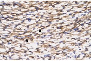 Rabbit Anti-CCL7 Antibody  Paraffin Embedded Tissue: Human Heart Cellular Data: Myocardial cells Antibody Concentration: 4. (CCL7 antibody  (N-Term))