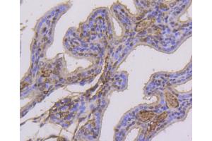 Paraformaldehyde-fixed, paraffin embedded mouse placenta, Antigen retrieval by boiling in sodium citrate buffer (pH6) for 15min, Block endogenous peroxidase by 3% hydrogen peroxide for 30 minutes, Blocking buffer at 37°C for 20min, Antibody incubation with Estrogen Receptor alpha(Ser118) (3A7) Monoclonal Antibody  at 1:50 overnight at 4°C, followed by a conjugated secondary and DAB staining. (Estrogen Receptor alpha antibody  (pSer118))