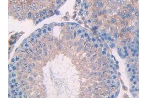 Detection of UBD in Rat Testis Tissue using Polyclonal Antibody to Ubiquitin D (UBD)